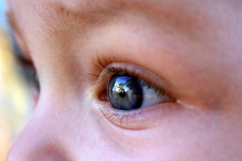 Gene therapy ‘restores’ kids’ colour vision