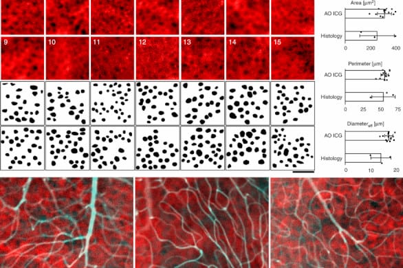 See it all by combining imaging modalities