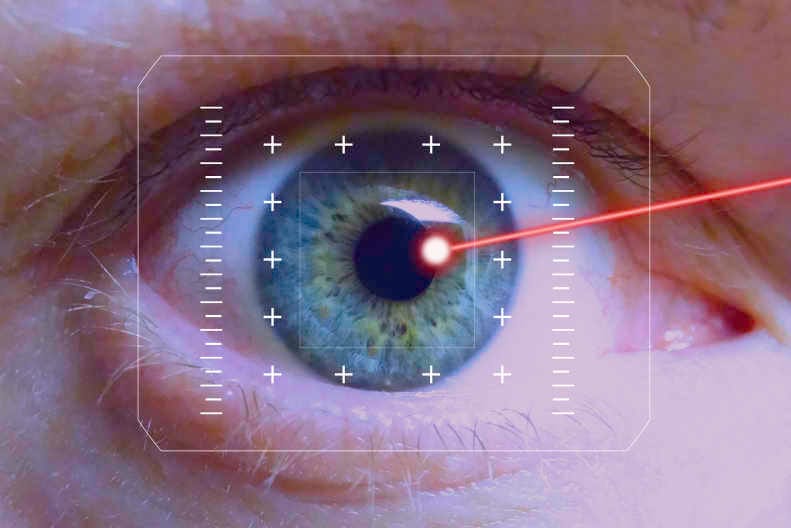 Non-surgical laser vision correction