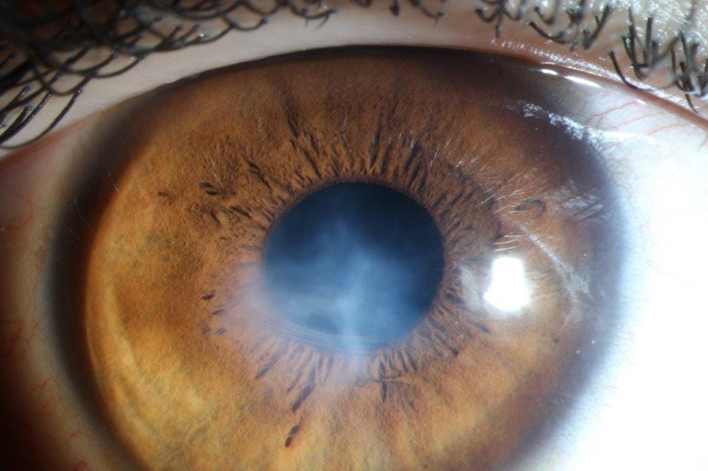Understanding the challenges and opportunities of Māori ocular health