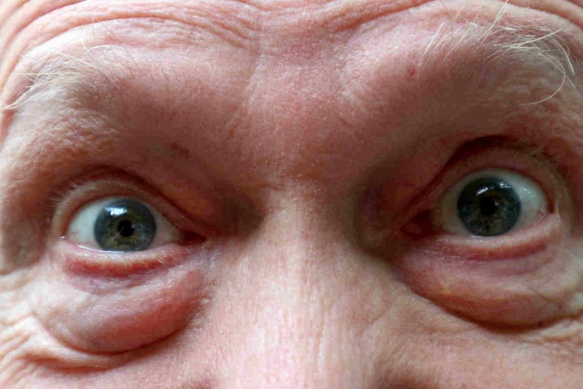 Dry AMD treatment trial fast tracked