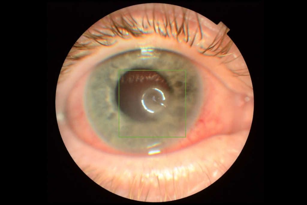 Case study: Steroids and strimmers