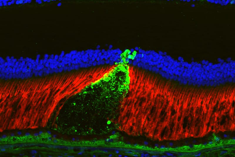 retina feb 26 online