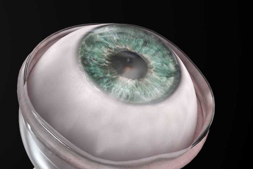 New synthetic cornea trial