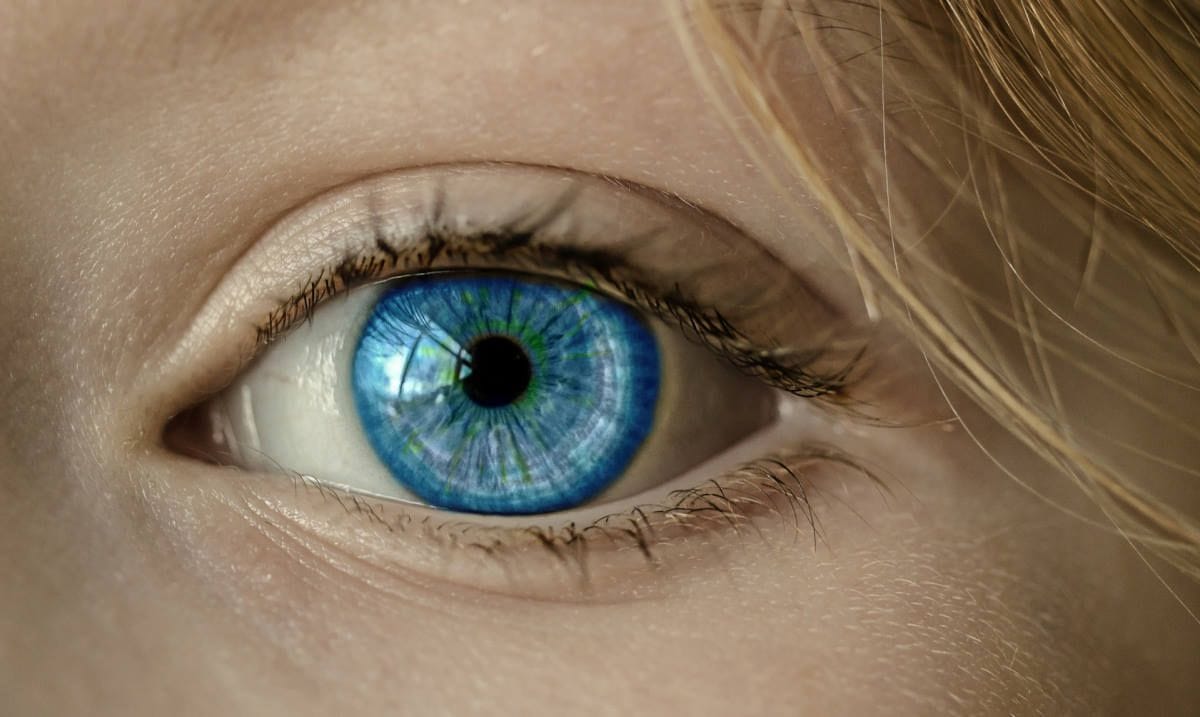 Intra-corneal microlens - positive six-month results