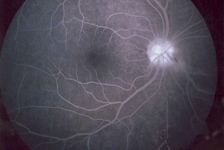 FA unsurpassed for DR