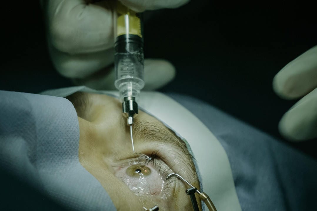 Anti-VEGFs poor outcomes for remission patients