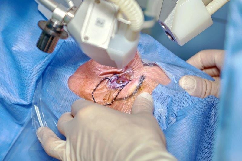 Cefuroxime irrigation to combat endophthalmitis