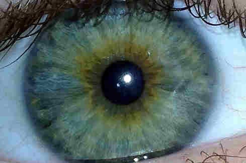 Not everyone loves LASIK