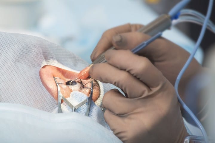 Junior surgeon thumbs-up for ISBCS
