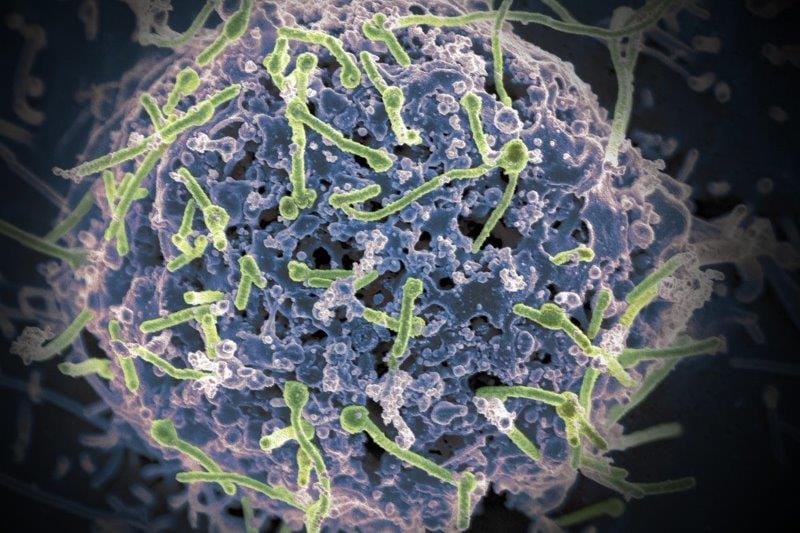 RPE a haven for Ebola