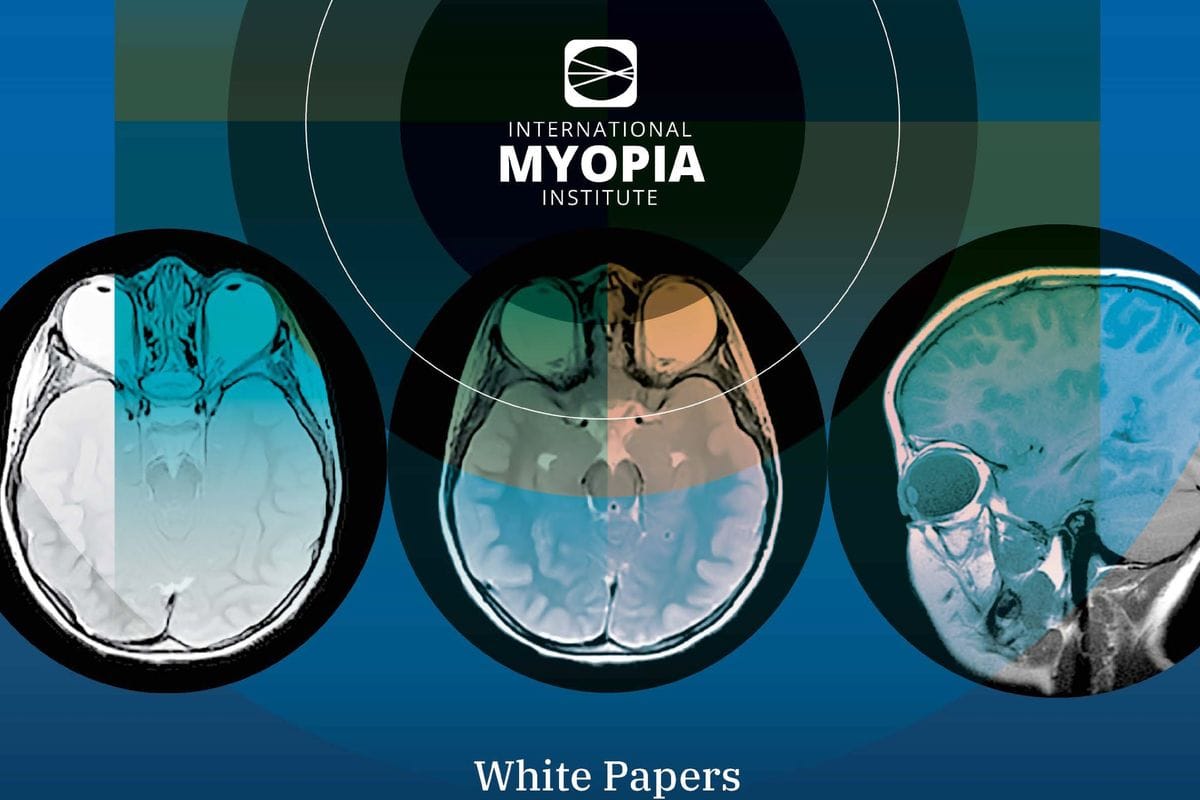 Myopia in practice: A summary of the IMI white papers