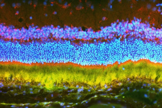 Nanoparticles: unlocking genetic eye therapy?