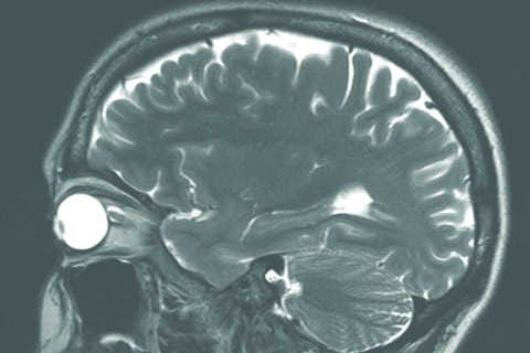 Kiwis propel portable MRI development