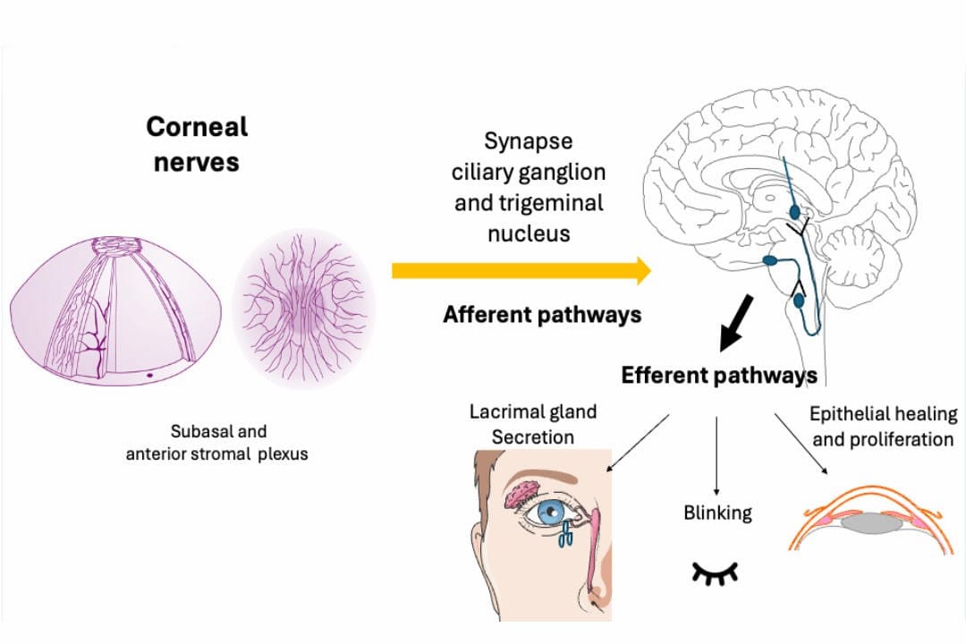 Understanding and treating corneal nerve dysfunction