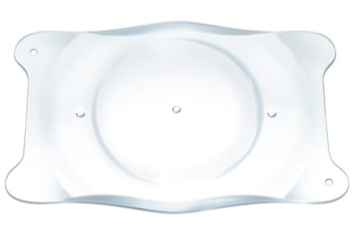 FDA approval for implantable myopia lens