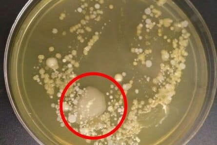 What saliva does to your CLs