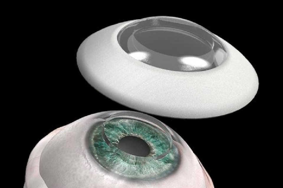 Glazing the windows to the soul