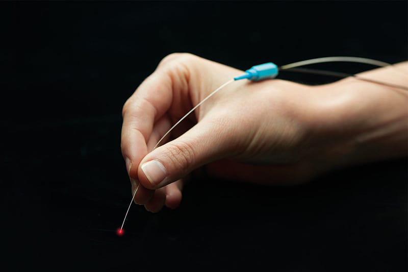 itrack ab interno canaloplasty microcatheter