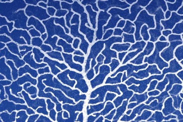microvascular tree