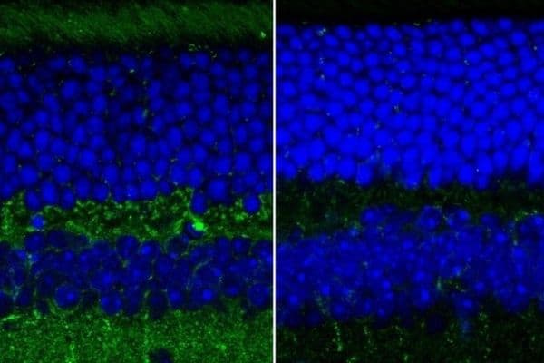 Retinal texture early sign of Alzheimer’s disease?