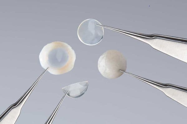 Long shelf-life corneas now in NZ