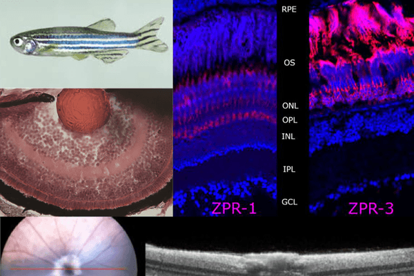 CRISPR - An eye on gene editing