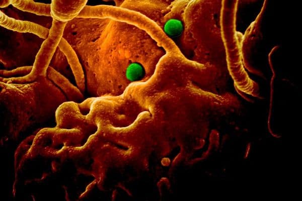 Coronavirus eye transfer alert