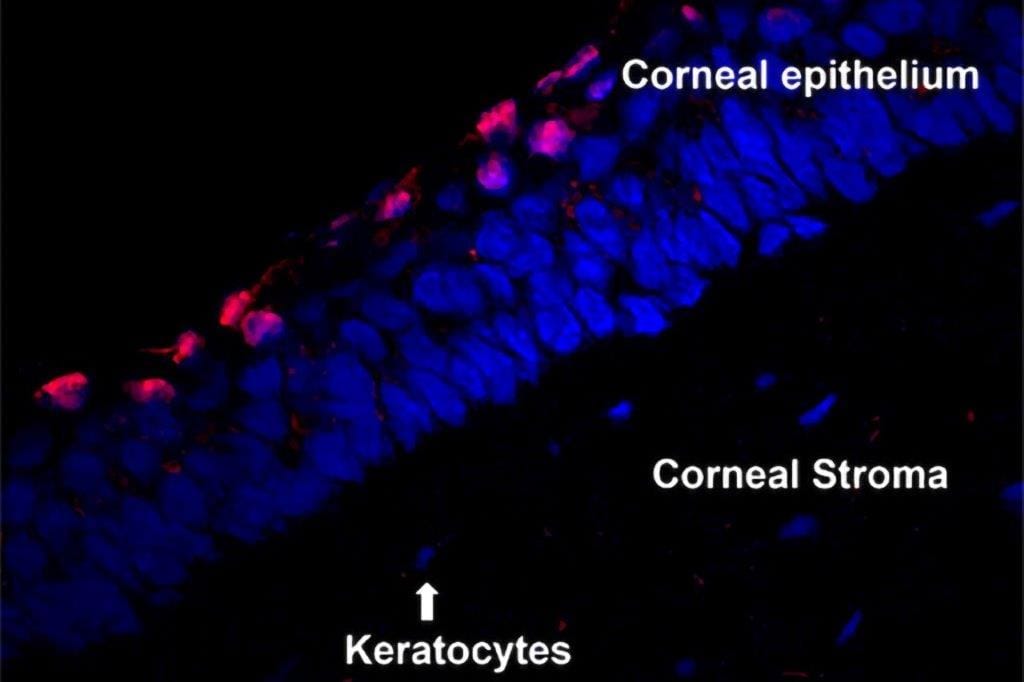 Shedding light on a novel microbial keratitis treatment strategy