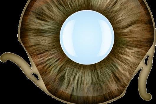 Reper’s prosthetic iris hits NZ