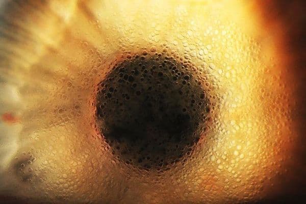 early stages of bullous keratopathy