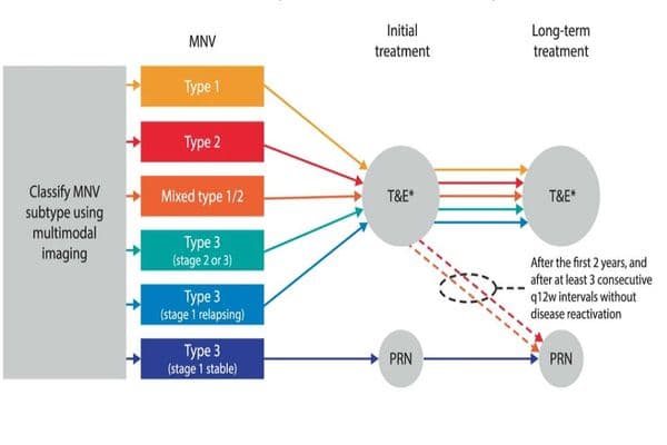 Study establishes AMD subtypes