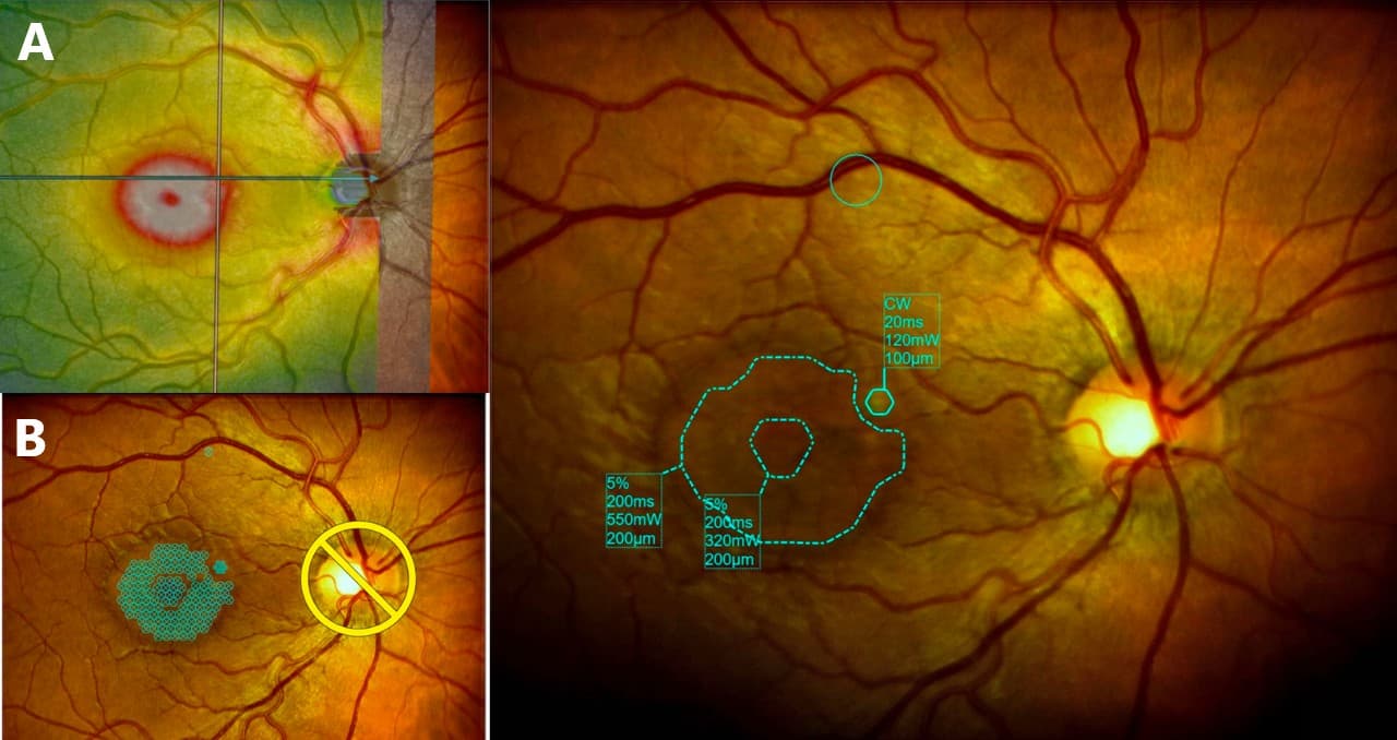 Fig 1 CSCR