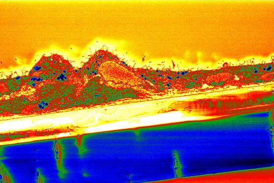 Fuelling the RPE to combat blindness