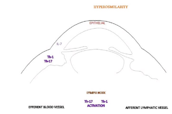 The role of inflammation in dry eye