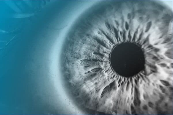 Glaucoma ocular implant clears phase I hurdle