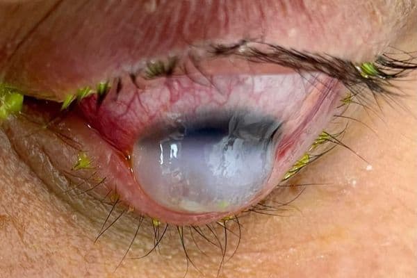 Catching the eye – the 2024 CCLS photo competition winners