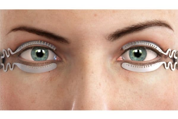 TearCare for MGD bags FDA approval