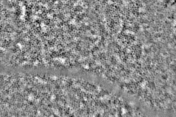 Clear RPE imaging for early diagnosis