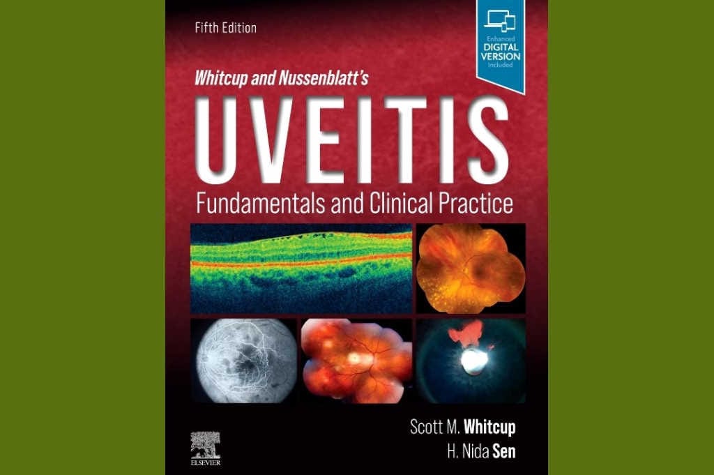 BOOK REVIEW: Whitcup and Nussenblatt's Uveitis 5th edition by Scott M Whitcup and H Nida Sen