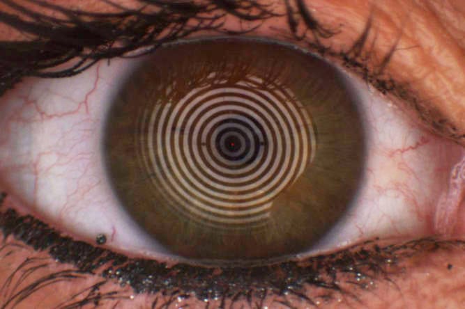 Cosmetics and the tear film