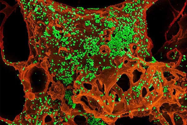 Coronavirus postpones APAO