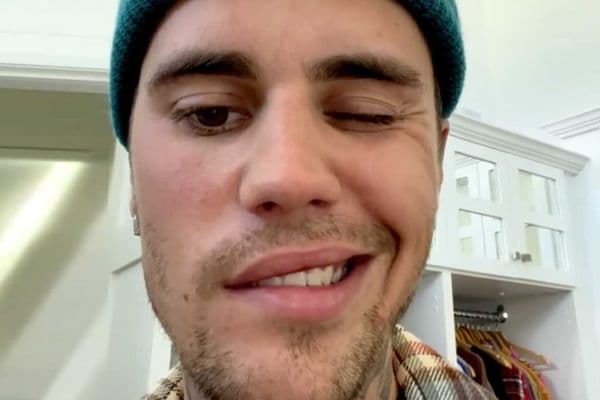 Stars and their eyes… Justin Bieber
