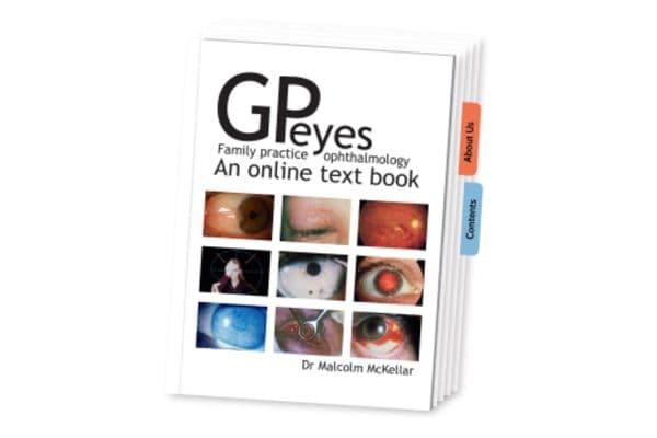 Free GP resource for common eye concerns