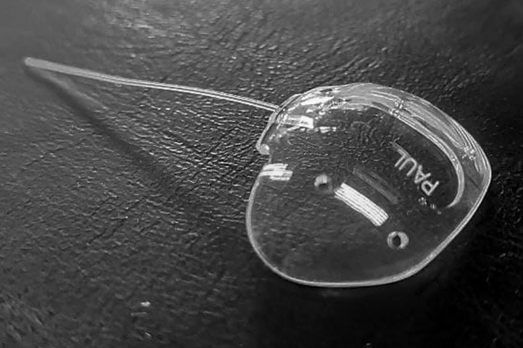 New tube designs a big step forward in glaucoma surgery