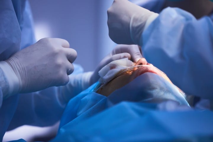 Oculoplastics: research review