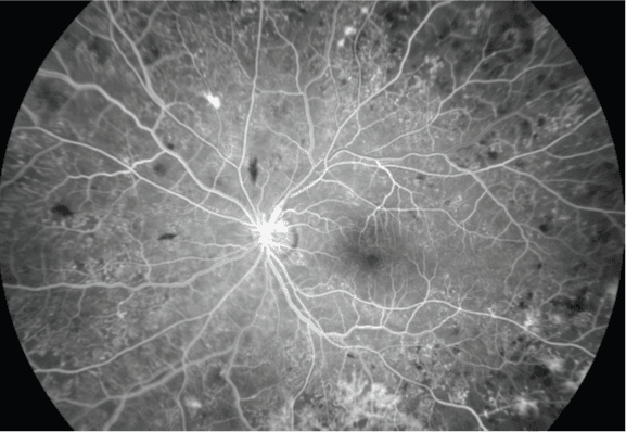 SPONSORED: Technology to empower – ZEISS CLARUS 700