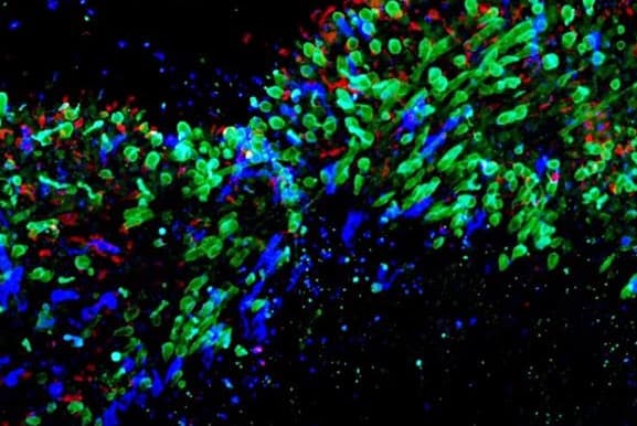 Scientists see how colour vision develops