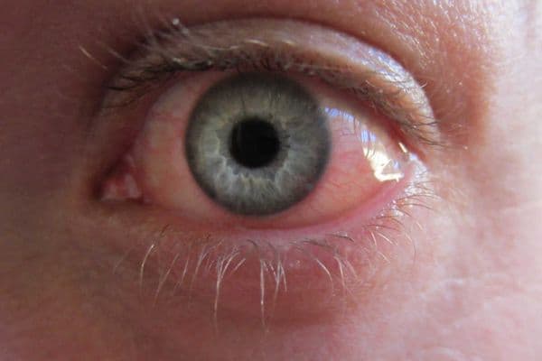 The OSL eye for an eye study