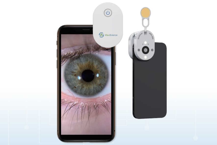 Pocket-sized eye imaging